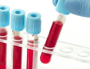 Krew sportowca - wszystko co musisz wiedzieć o badaniach krwi.